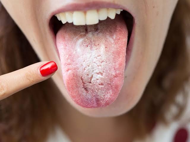 lengua blanca